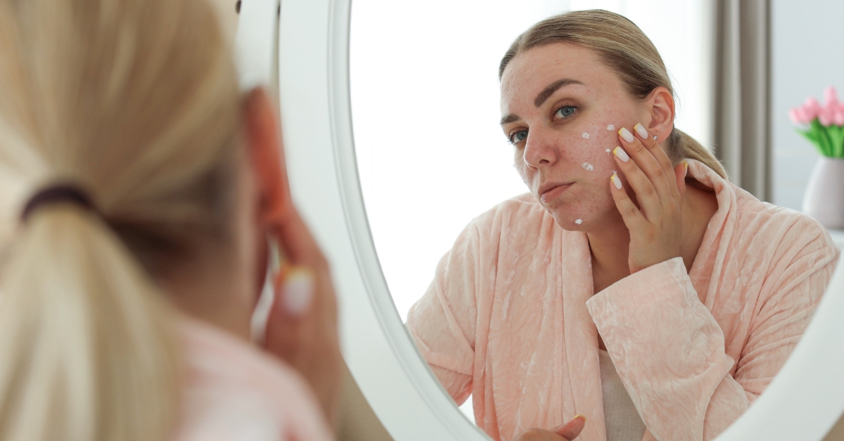 These Are The Best Acne Treatment Products on Amazon You Can Trust For Clear Skin